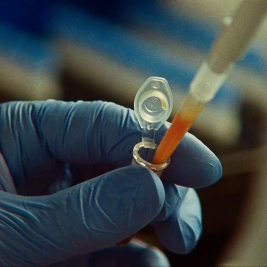 Đồ họa mô phỏng các đoạn DNA lặp trong hệ thống ART