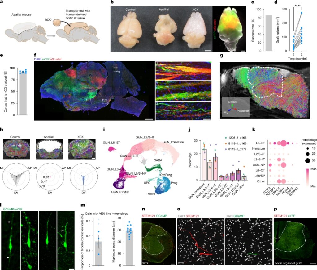 Minh họa organoid não người được phát triển trong phòng thí nghiệm